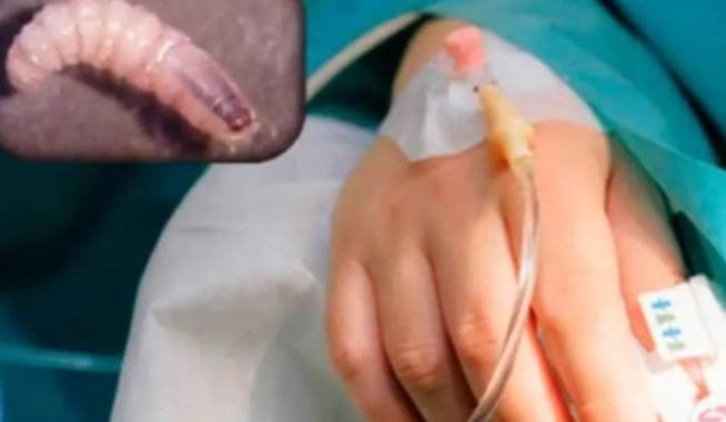Crisis de miasis por gusano barrenador en Campeche